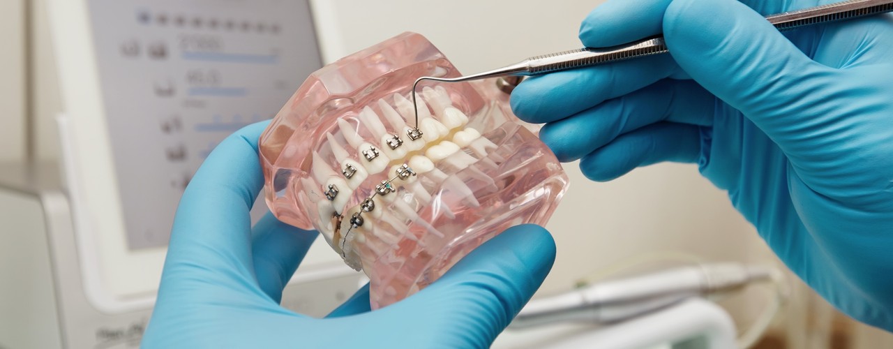 1-dentiste-tenant-un-modele-en-plastique-dentaire-avec-des-accolades